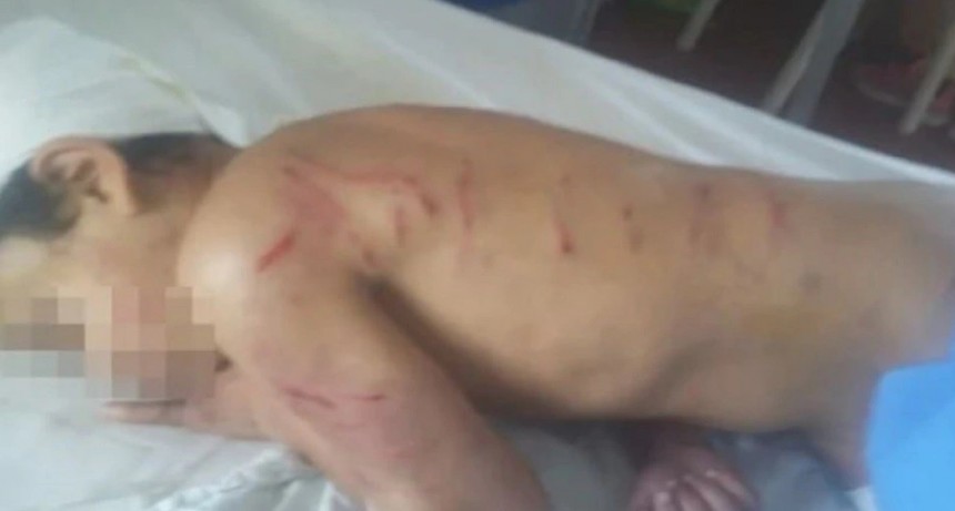 Una jauría atacó a un nene de 9 años en Mar del Plata: 