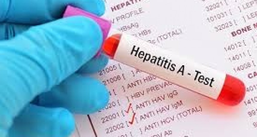 Hepatitis A: ¿Qué es y cómo prevenirla?